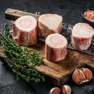 תמונה של עצמות מח